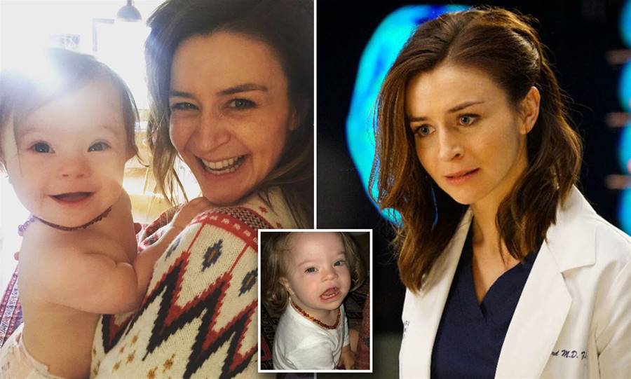Canadian "Grey's Anatomy" Star Caterina Scorsone Announces Pregnancy, Cast Thrilled!!!