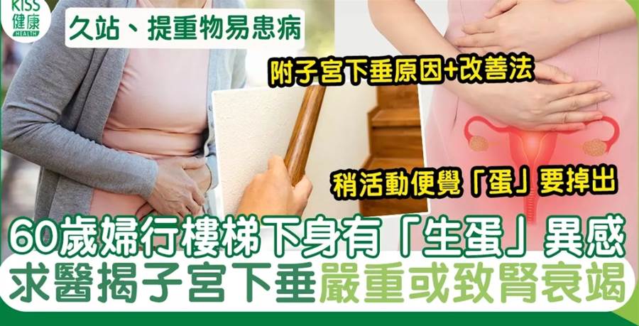 子宮下垂原因+1套運動預防｜60歲婦行樓梯忽有「生蛋」異感 醫：子宮掉出來